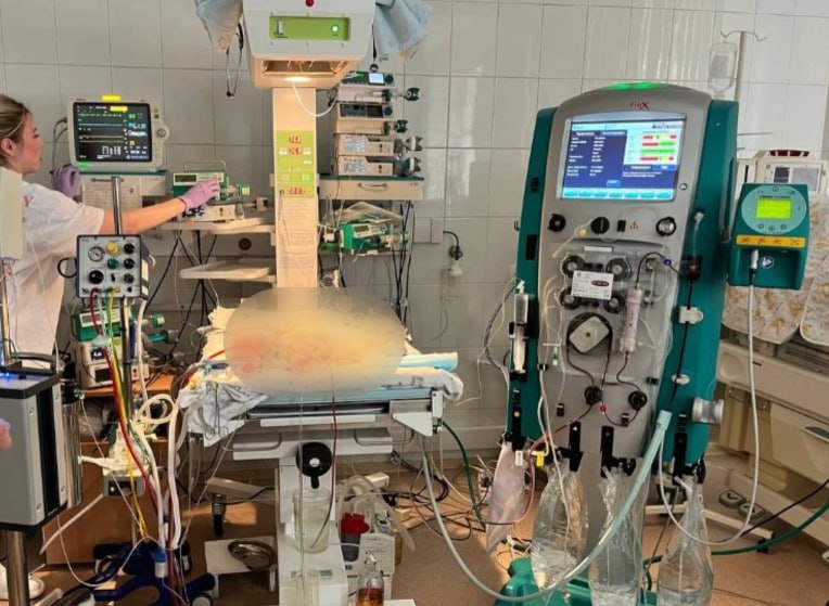 В Удмуртии врачи спасли ребенка с тяжелым сепсисом