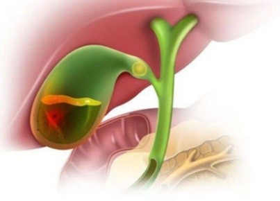 ��� ���������� ����� ����� �������� �������� ������: �������� ����