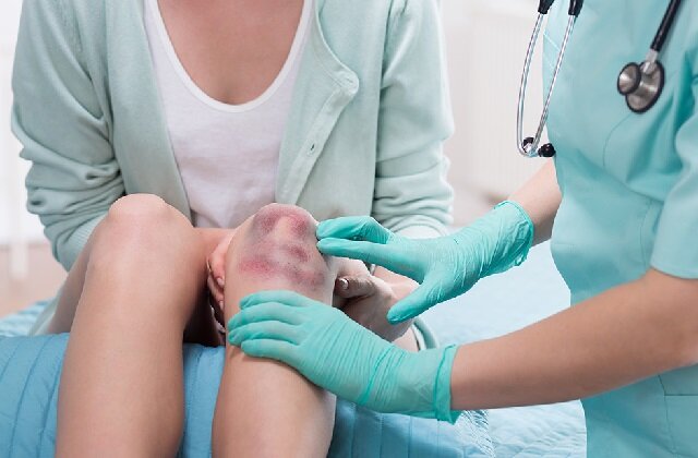 Способы быстрого устранения гематомы: от компрессов до массажей